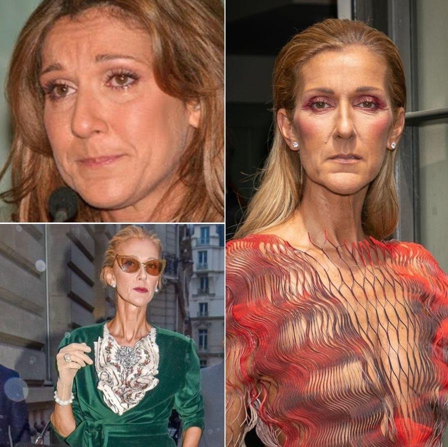 Céline Dion's condition continues to deteriorate: she cancels her ...